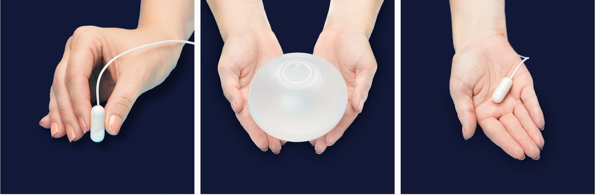 Intra-Gastric Balloon - Surgicare Stomach Cancer, Bariatric and Upper ...
