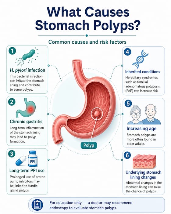 Causes of Stomach Polyps